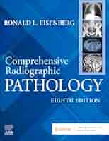 講座スポーツ整形外科学 = Comprehensive Handbook of… 61i+SxW9kfL._SY200_QL15_.jpg